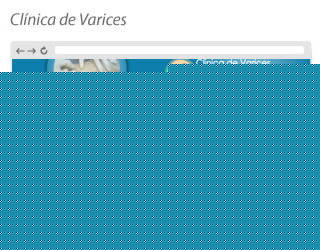 varice y espuma